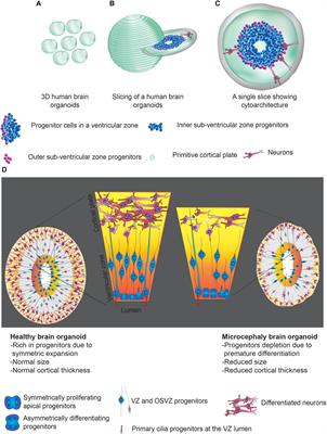 Human <mark class="highlighted">Brain Organoids</mark> to Decode Mechanisms of Microcephaly